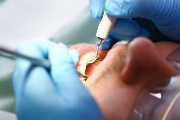 Best Broken Tooth Emergency  in Harrison, OH