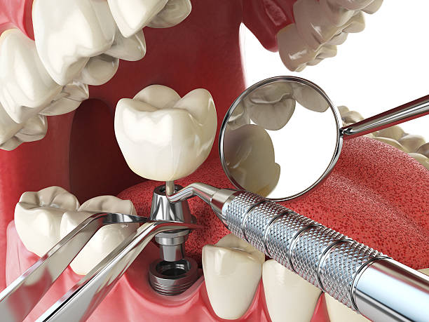 Best Urgent Tooth Repair  in Harrison, OH